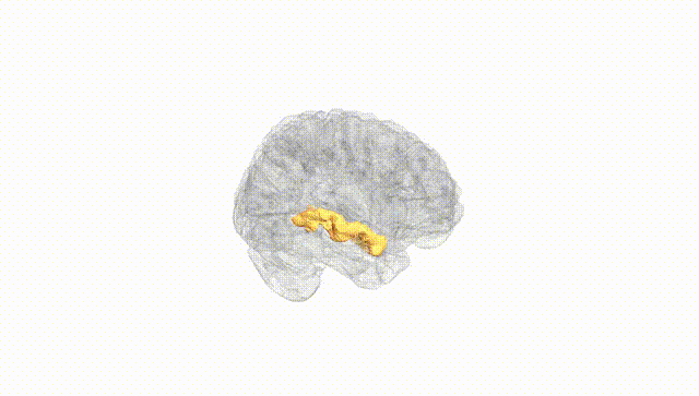 Full Brain White