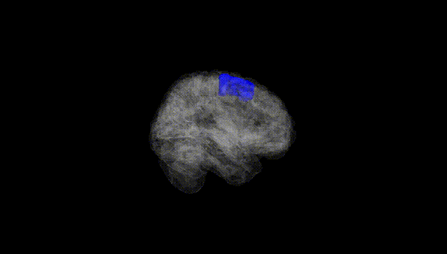 Full Brain Black