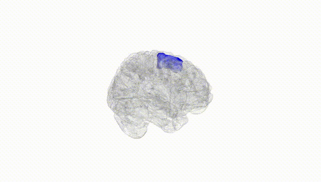 Full Brain White