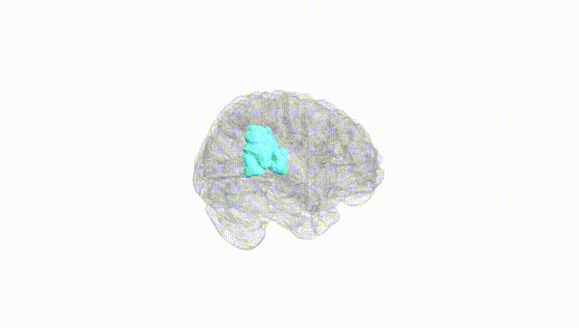 Full Brain White