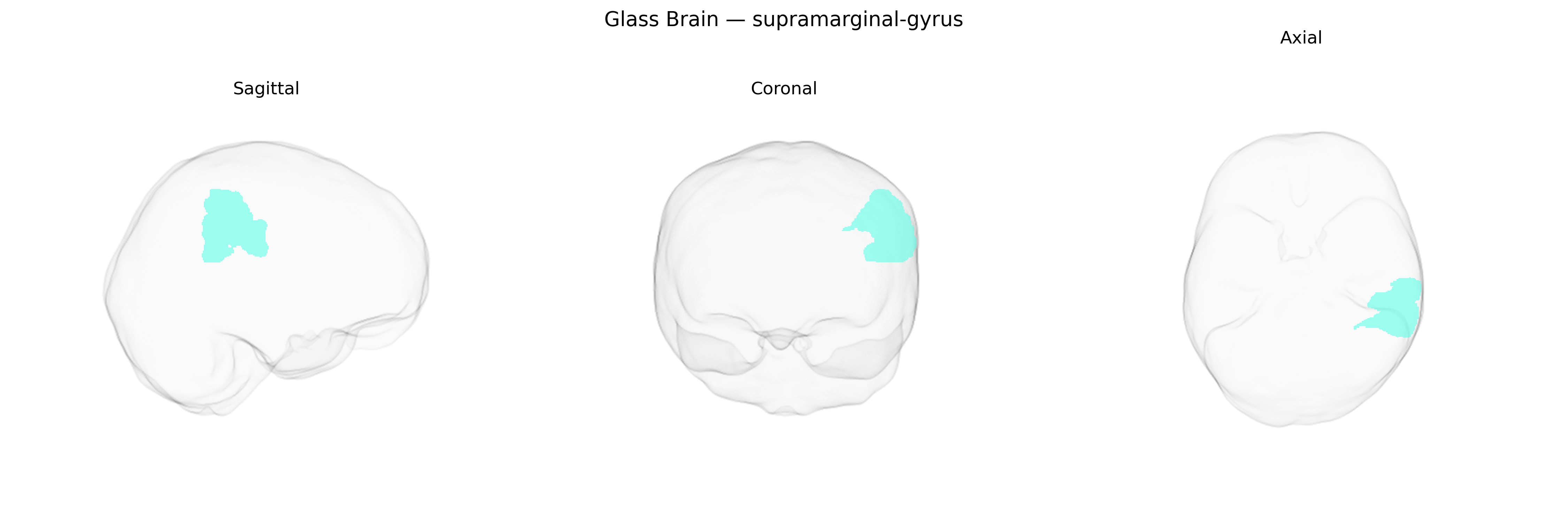 Triplanar Ghost Brain