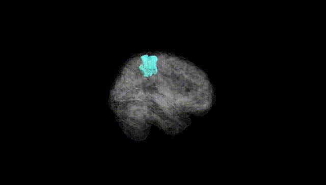Full Brain Black
