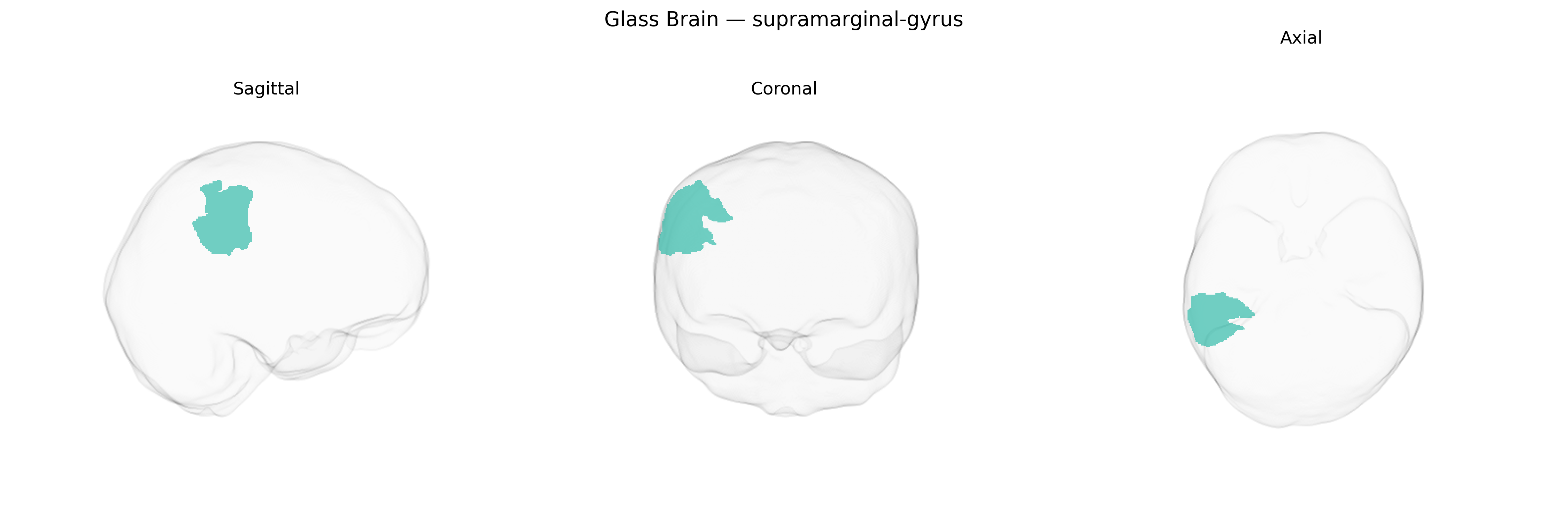 Triplanar Ghost Brain