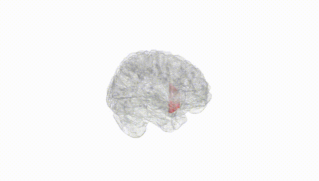 Full Brain White