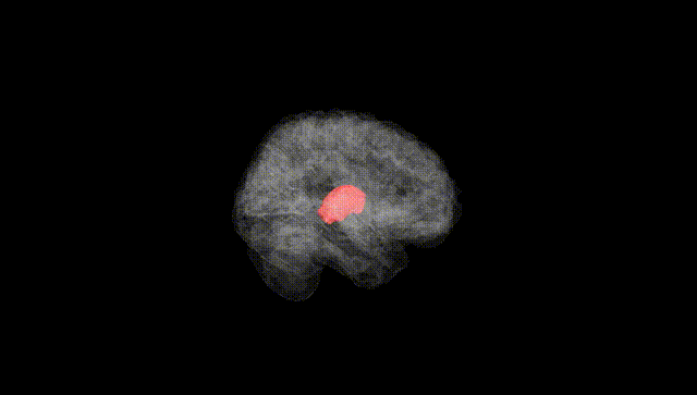 Full Brain Black