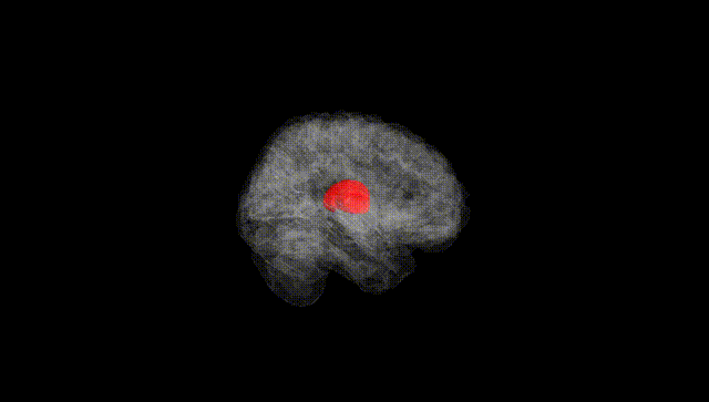 Full Brain Black