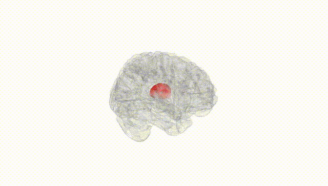 Full Brain White