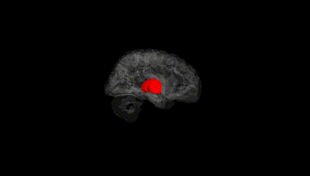 Hemisphere Black