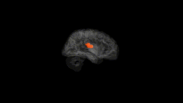 Hemisphere Black