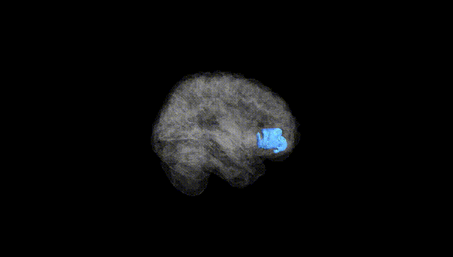 Full Brain Black