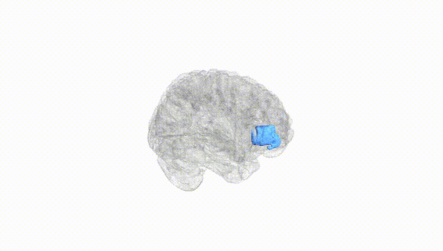 Full Brain White