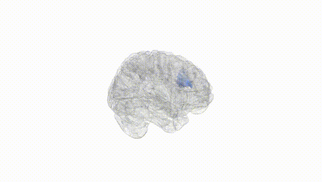 Full Brain White
