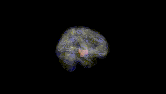 Full Brain Black
