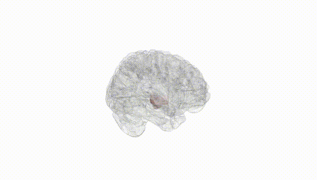 Full Brain White