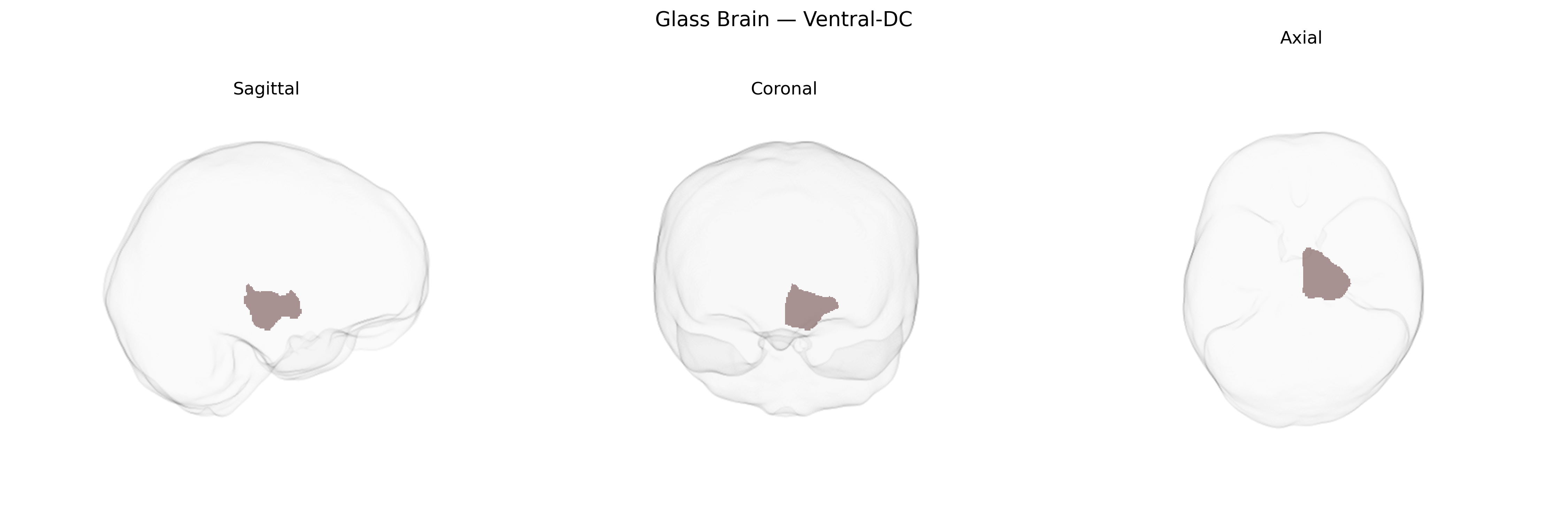 Triplanar Ghost Brain