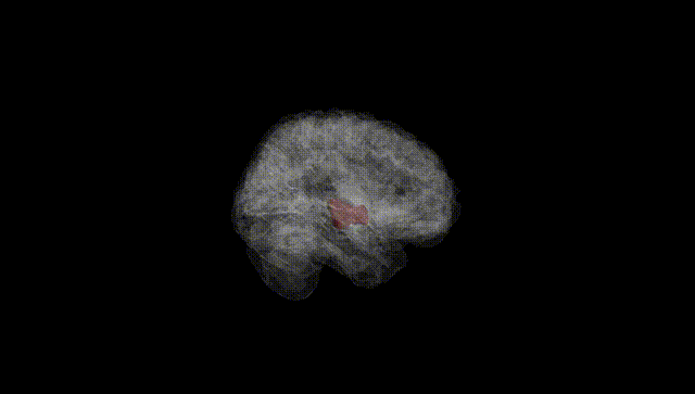 Full Brain Black