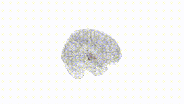 Full Brain White