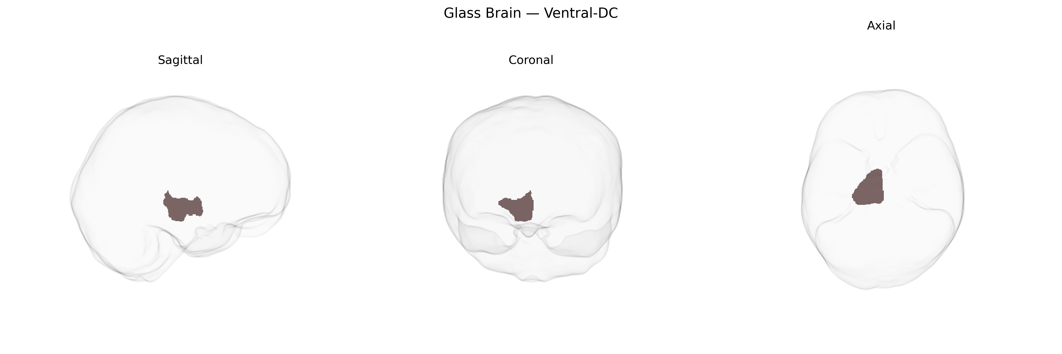 Triplanar Ghost Brain