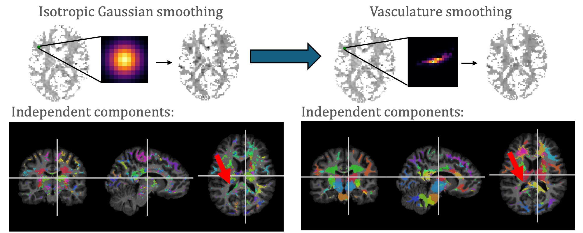 Vasculature Smoothing preview
