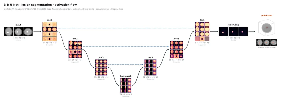 3-D U-Net, projection view activation flow figure